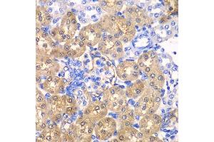 Immunohistochemistry of paraffin-embedded rat kidney using HPD antibody. (HPD anticorps  (AA 1-393))
