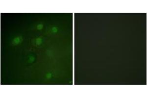Immunofluorescence analysis of HeLa cells, using PDCD4 (Ab-457) Antibody. (PDCD4 anticorps  (AA 420-469))