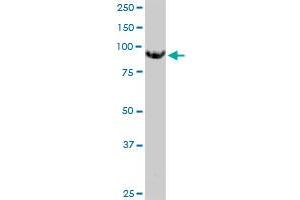 MGAT5 monoclonal antibody (M09), clone 3E9.
