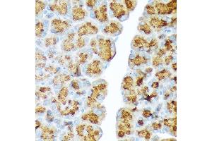 Immunohistochemistry of paraffin-embedded rat pancreas using CTRL Rabbit mAb (ABIN7266395) at dilution of 1:100 (40x lens). (Chymotrypsin anticorps)