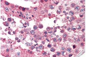 Human Testis (formalin-fixed, paraffin-embedded) stained with IKBKAP antibody ABIN214497 at 2.