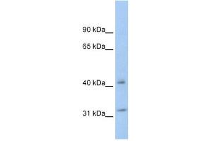 YWHAQ antibody (70R-10463) used at 0. (14-3-3 theta anticorps  (N-Term))