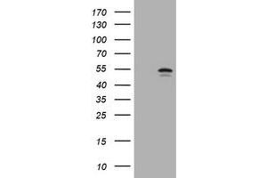 Image no. 1 for anti-Vimentin (VIM) antibody (ABIN1501722) (Vimentin anticorps)