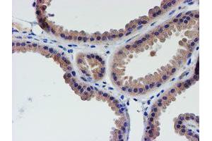 Immunohistochemical staining of paraffin-embedded Human breast tissue using anti-LECT2 mouse monoclonal antibody. (LECT2 anticorps  (AA 19-151))