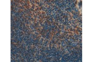 Used in DAB staining on fromalin fixed paraffin- embedded spleen tissue (SKAP1 anticorps  (AA 1-355))