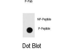 Dot blot analysis of anti-Phospho-ANTXR1-p Antibody (ABIN389930 and ABIN2839748) on nitrocellulose membrane. (ANTXR1 anticorps  (pTyr382))