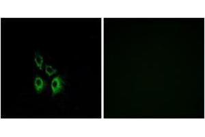 Immunofluorescence analysis of A549 cells, using ADRA1A Antibody. (alpha 1 Adrenergic Receptor anticorps  (AA 136-185))