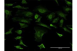 Immunofluorescence of monoclonal antibody to SNCB on HeLa cell. (beta Synuclein anticorps  (AA 1-134))