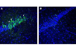 Expression of 5HT2C in mouse hippocampus. (HTR2C anticorps  (Extracellular))