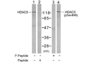 Image no. 2 for anti-Histone Deacetylase 5 (HDAC5) (pSer498) antibody (ABIN196932) (HDAC5 anticorps  (pSer498))