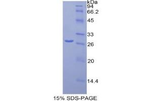 SDS-PAGE analysis of Mouse Orosomucoid 1 Protein. (ORM1 Protéine)