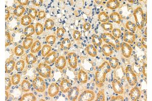 ABIN6260082 and ABIN6272540 at 1/100 staining Rat kidney tissue by IHC-P. (ASPM anticorps  (Internal Region))