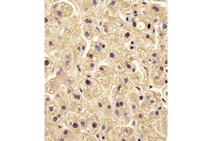 Antibody staining PGM1 in human liver tissue sections by Immunohistochemistry (IHC-P - paraformaldehyde-fixed, paraffin-embedded sections). (Phosphoglucomutase 1 anticorps  (AA 251-282))
