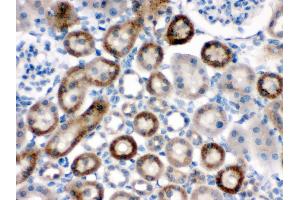 Anti-NOX1 antibody, HC(P) HC(P): Rat Kidney Tissue (NOX1 anticorps  (Middle Region))