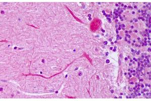 anti-Insulin-Like Growth Factor 2 (IGF2) antibody