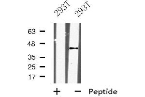 Western blot analysis of KLF12 expression in 293T whole cell lysate ,The lane on the left is treated with the antigen-specific peptide. (KLF12 anticorps  (Internal Region))