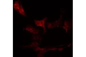 ABIN6276467 staining  HeLa cells by IF/ICC.