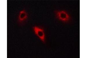ABIN6267668 staining PC12 cells by ICC/IF. (DPYSL2 anticorps  (pThr514))