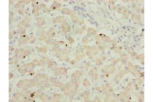 Immunohistochemistry of paraffin-embedded human liver tissue using ABIN7144733 at dilution of 1:100