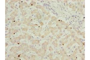 Immunohistochemistry of paraffin-embedded human liver tissue using ABIN7144733 at dilution of 1:100 (GOT2 anticorps  (AA 33-279))