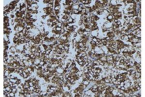 ABIN6276378 at 1/100 staining Mouse testis tissue by IHC-P. (DDX58 anticorps  (N-Term))