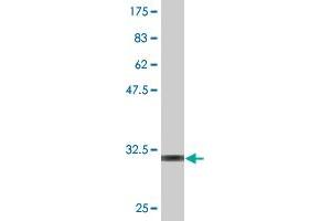 Western Blot detection against Immunogen (32. (KAT2B anticorps  (AA 367-432))