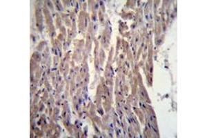 Immunohistochemistry analysis in human heart tissue (Formalin-fixed, Paraffin-embedded) using MYBPC3 Antibody (N-term), followed by peroxidase conjugated secondary antibody and DAB staining.