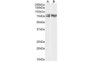 ABIN5539550 (1µg/ml) staining of HeLa (A) and NIH3T3 (B) lysate (35µg protein in RIPA buffer). (LIMK2 anticorps  (AA 181-193))
