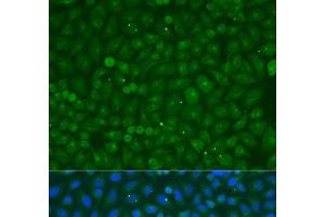Immunofluorescence analysis of U2OS cells using COG4 Polyclonal Antibody at dilution of 1:100. (COG4 anticorps)