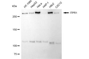 Western blotting analysis using ITPR1 antibody (ABIN7799041).