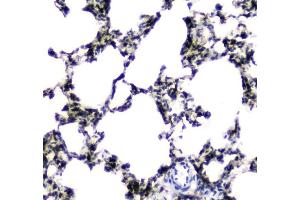 IHC analysis of CES1 using anti-CES1 antibody (ABIN5693010).