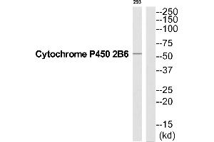 Western blot analysis of extracts from 293 cells, using Cytochrome P450 2B6 antibody.