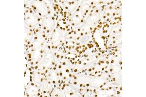 Immunohistochemistry of paraffin-embedded rat kidney using Phospho-ST-Y705 Rabbit mAb (ABIN6135325, ABIN6136266, ABIN6136267 and ABIN7101883) at dilution of 1:100 (40x lens).