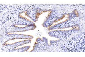 Detection of MMP2 in Human Lung Tissue using Polyclonal Antibody to Matrix Metalloproteinase 2 (MMP2)