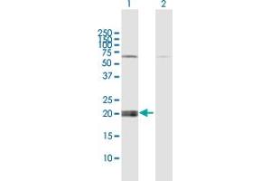 Western Blot analysis of IFNE expression in transfected 293T cell line by IFNE MaxPab polyclonal antibody. (IFNE anticorps  (AA 1-208))