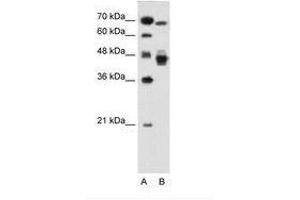 Image no. 1 for anti-Nuclear Receptor Subfamily 2, Group F, Member 6 (NR2F6) (AA 21-70) antibody (ABIN6736681) (NR2F6 anticorps  (AA 21-70))