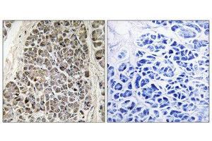 Immunohistochemistry (IHC) image for anti-Mitochondrial Ribosomal Protein S21 (MRPS21) (Internal Region) antibody (ABIN1851552) (MRPS21 anticorps  (Internal Region))