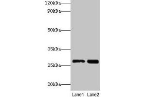 Western blot All lanes: LGALS3 antibody at 2 μg/mL Lane 1: Hela whole cell lysate Lane 2: MCF-7 whole cell lysate Secondary Goat polyclonal to rabbit IgG at 1/10000 dilution Predicted band size: 27 kDa Observed band size: 27 kDa (Galectin 3 anticorps  (AA 2-250))