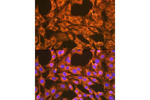 Immunofluorescence analysis of C6 cells using VD Rabbit pAb (ABIN7271337) at dilution of 1:100 (40x lens).