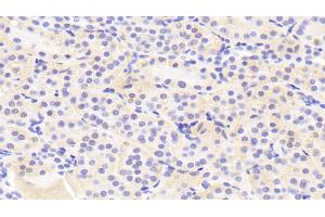 Detection of GTF2H5 in Human Kidney Tissue using Polyclonal Antibody to General Transcription Factor IIH, Polypeptide 5 (GTF2H5) (GTF2H5 anticorps  (AA 1-71))