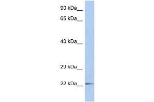 DUT antibody used at 1 ug/ml to detect target protein. (Deoxyuridine Triphosphatase (DUT) (N-Term) anticorps)
