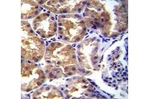 TRPM6 antibody immunohistochemistry analysis in formalin fixed and paraffin embedded human kidney tissue.