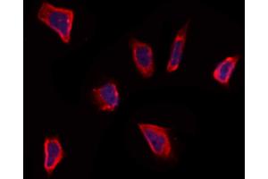 ABIN6264114 and ABIN6273293 staining Hela by IF/ICC.