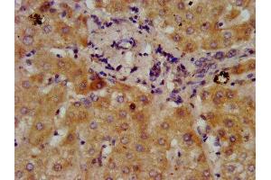 IHC image of ABIN7149966 diluted at 1:300 and staining in paraffin-embedded human liver tissue performed on a Leica BondTM system.