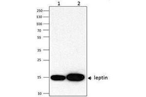 Western Blotting (WB) image for anti-Leptin (LEP) antibody (ABIN2665227) (Leptin anticorps)