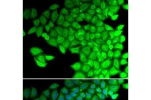 Immunofluorescence analysis of HeLa cells using MYL2 Polyclonal Antibody