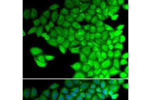 Immunofluorescence analysis of HeLa cells using MYL2 Polyclonal Antibody (MYL2 anticorps)