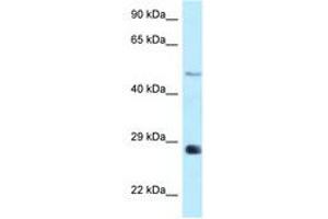Image no. 1 for anti-1-Acylglycerol-3-Phosphate O-Acyltransferase 9 (AGPAT9) (AA 199-248) antibody (ABIN6748085)
