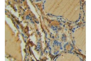 Detection of FAK in Human Thyroid Tissue using Polyclonal Antibody to Focal Adhesion Kinase (FAK)