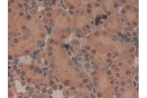 Detection of CD2AP in Rat Kidney Tissue using Polyclonal Antibody to CD2 Associated Protein (CD2AP) (CD2AP anticorps  (AA 368-623))
